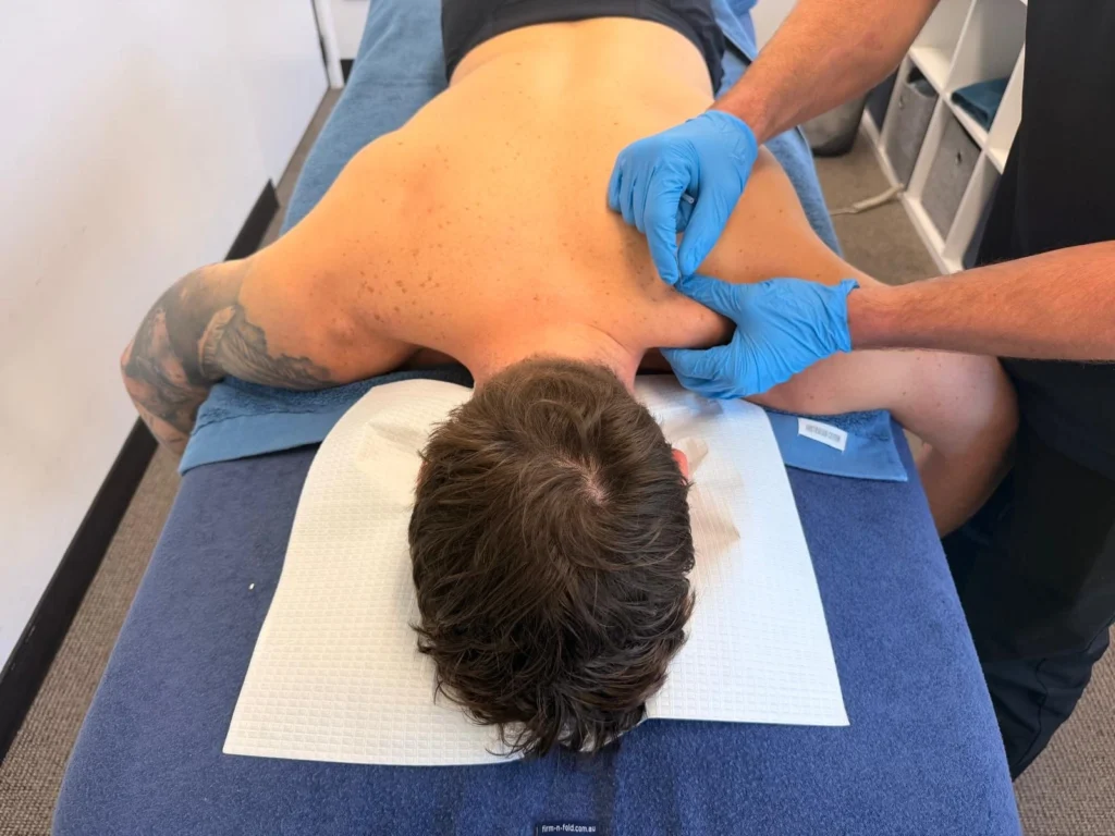 Dry needling treatment at Invigor Health Maroubra