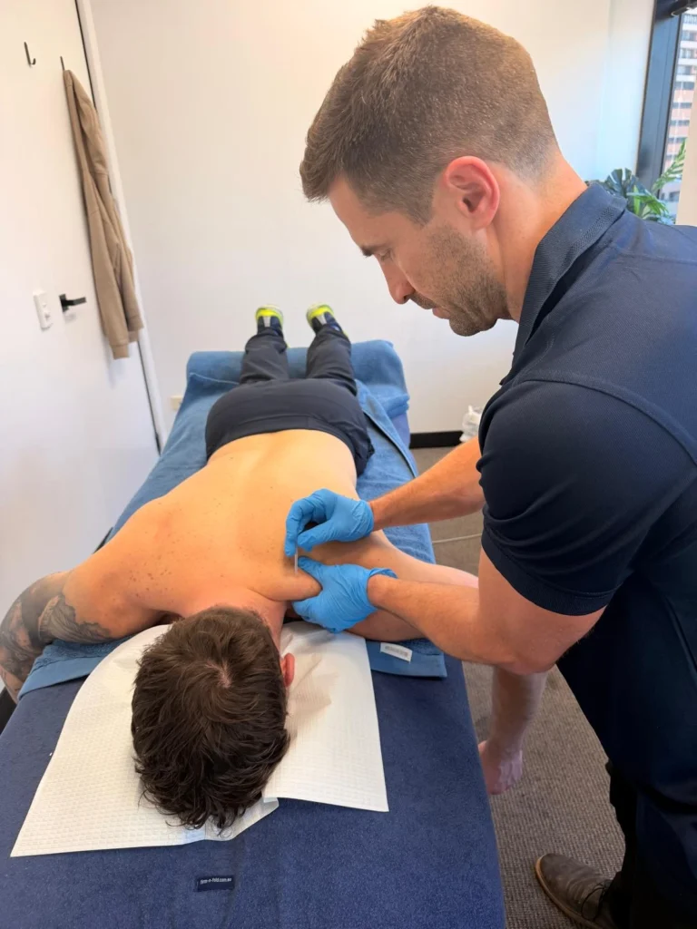 Sports physiotherapy treatment at Invigor Health Bondi Junction